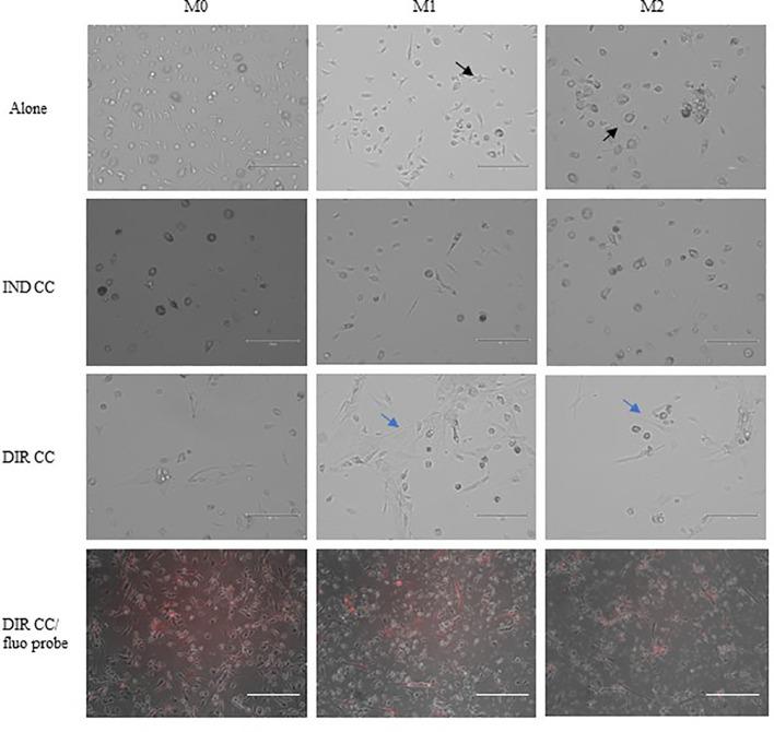 https://cdn.ncbi.nlm.nih.gov/pmc/blobs/930b/11499095/216b40cdef81/fimmu-15-1440974-g001.jpg
