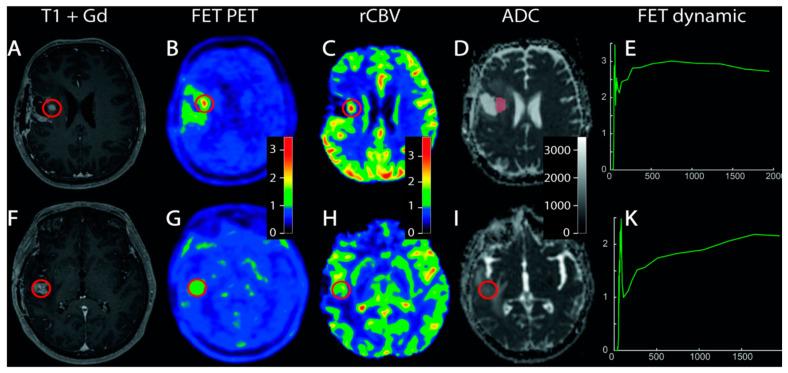 https://cdn.ncbi.nlm.nih.gov/pmc/blobs/930f/9856914/6ab75348976c/cancers-15-00364-g003.jpg