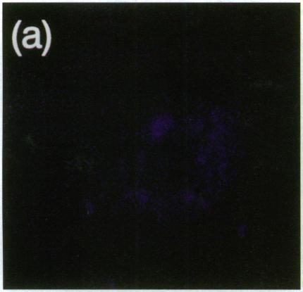 https://cdn.ncbi.nlm.nih.gov/pmc/blobs/9310/296276/a1712c341ee9/jcinvest00019-0031-a.jpg