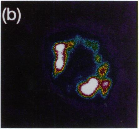 https://cdn.ncbi.nlm.nih.gov/pmc/blobs/9310/296276/fff0ac4fce44/jcinvest00019-0031-b.jpg