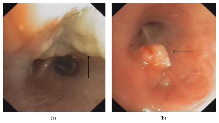 https://cdn.ncbi.nlm.nih.gov/pmc/blobs/9311/4706952/034bf08bd8e7/CRIPU2015-970548.002.jpg
