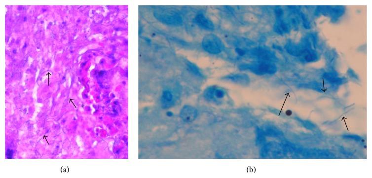 https://cdn.ncbi.nlm.nih.gov/pmc/blobs/9311/4706952/c4fe0bef0151/CRIPU2015-970548.003.jpg
