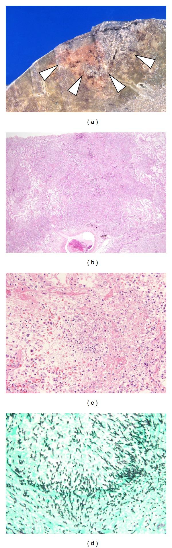 https://cdn.ncbi.nlm.nih.gov/pmc/blobs/9316/3853935/64f5b43ec138/MI2013-809798.002.jpg