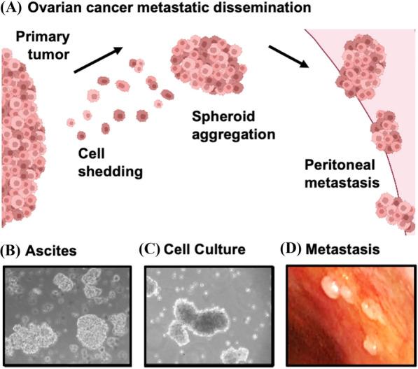 https://cdn.ncbi.nlm.nih.gov/pmc/blobs/9326/8944075/ec27bb9fd3c3/13008_2022_79_Fig1_HTML.jpg