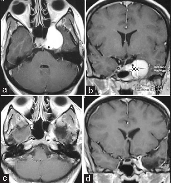 https://cdn.ncbi.nlm.nih.gov/pmc/blobs/9329/5532921/bb3aec7e5d94/AJNS-12-398-g002.jpg