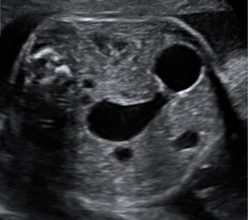 https://cdn.ncbi.nlm.nih.gov/pmc/blobs/9332/8429860/dcbd12e8a934/tp-10-08-2225-f1.jpg