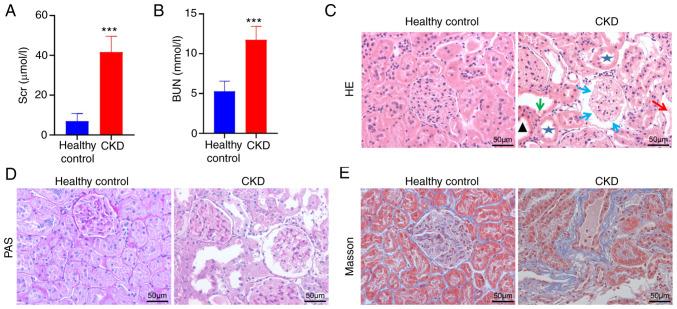 https://cdn.ncbi.nlm.nih.gov/pmc/blobs/9334/9780523/0507e95cf488/etm-25-01-11759-g12.jpg