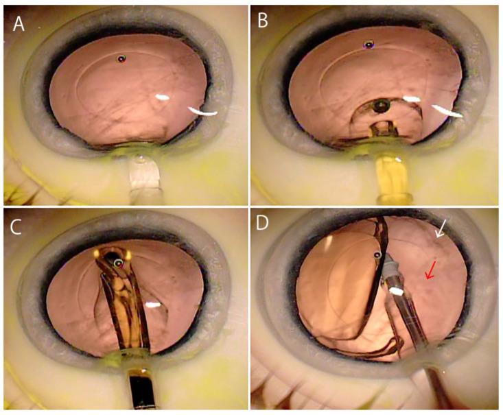 https://cdn.ncbi.nlm.nih.gov/pmc/blobs/9336/8397035/1632eef66e04/jcm-10-03611-g003.jpg