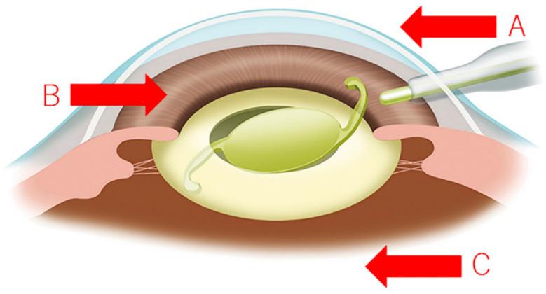 https://cdn.ncbi.nlm.nih.gov/pmc/blobs/9336/8397035/7d1183357838/jcm-10-03611-g004.jpg