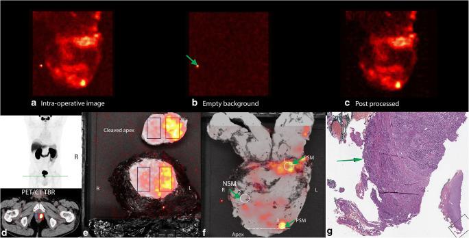 https://cdn.ncbi.nlm.nih.gov/pmc/blobs/9339/7515945/716ce927cff1/259_2020_4783_Fig2_HTML.jpg
