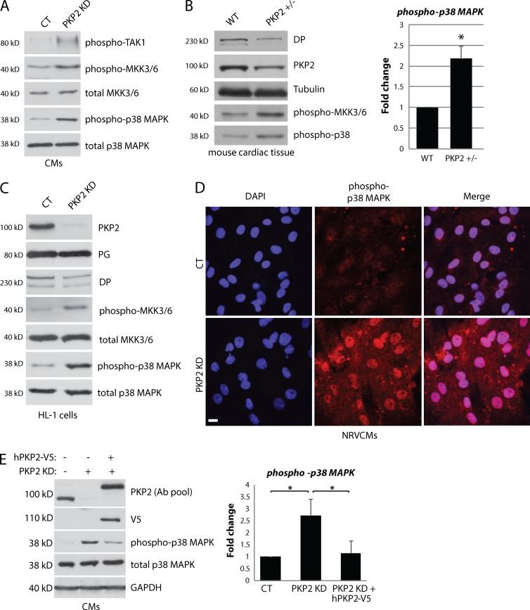 https://cdn.ncbi.nlm.nih.gov/pmc/blobs/933a/4754716/f69de35ecdc3/JCB_201507018_Fig3.jpg