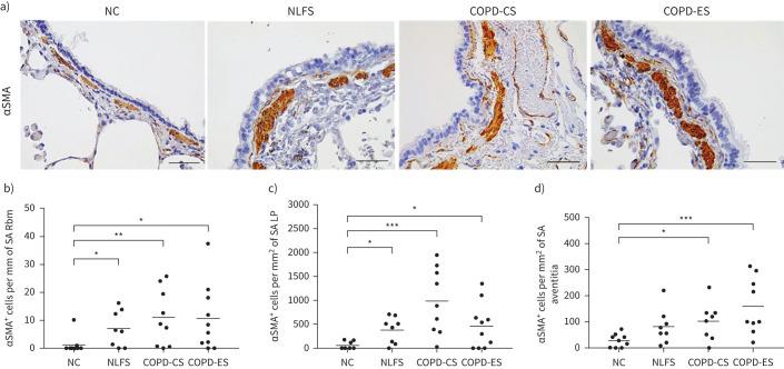 https://cdn.ncbi.nlm.nih.gov/pmc/blobs/933e/8181830/63c032dd50c9/00876-2020.03.jpg