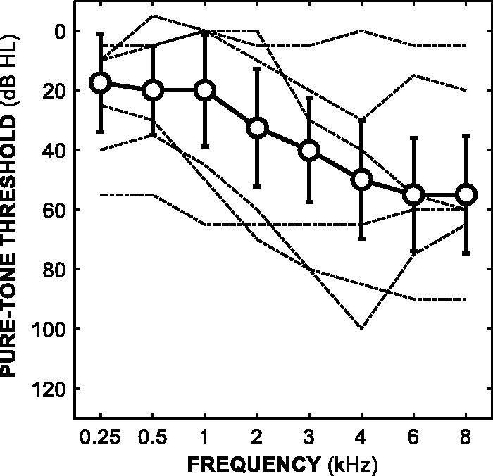 https://cdn.ncbi.nlm.nih.gov/pmc/blobs/934d/6351966/34be72994828/10.1177_2331216518820220-fig1.jpg