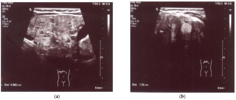 https://cdn.ncbi.nlm.nih.gov/pmc/blobs/9350/10820469/9fba241c40b2/medicina-60-00135-g001.jpg
