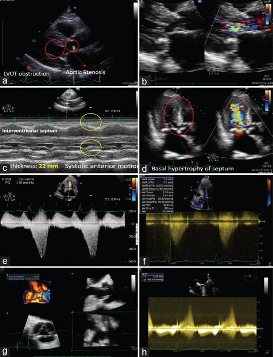 https://cdn.ncbi.nlm.nih.gov/pmc/blobs/9354/7706381/67d90de74fd0/JCE-30-104-g004.jpg