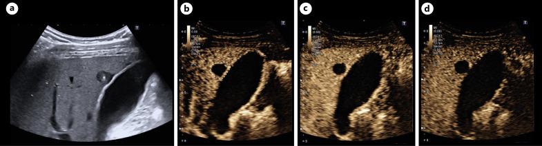 https://cdn.ncbi.nlm.nih.gov/pmc/blobs/9357/12143886/0bbc3944e2d4/vis-2025-0000-0000-545080_F06.jpg