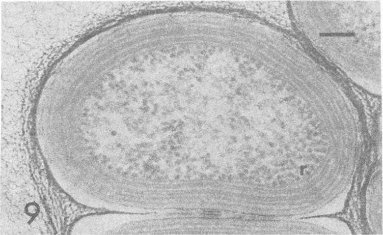 https://cdn.ncbi.nlm.nih.gov/pmc/blobs/935b/169790/22cc30ad5c6f/aem00003-0116-e.jpg