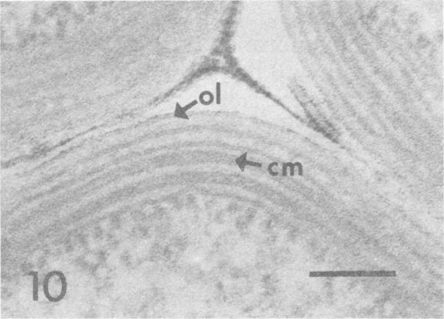 https://cdn.ncbi.nlm.nih.gov/pmc/blobs/935b/169790/47352a8f5553/aem00003-0116-d.jpg