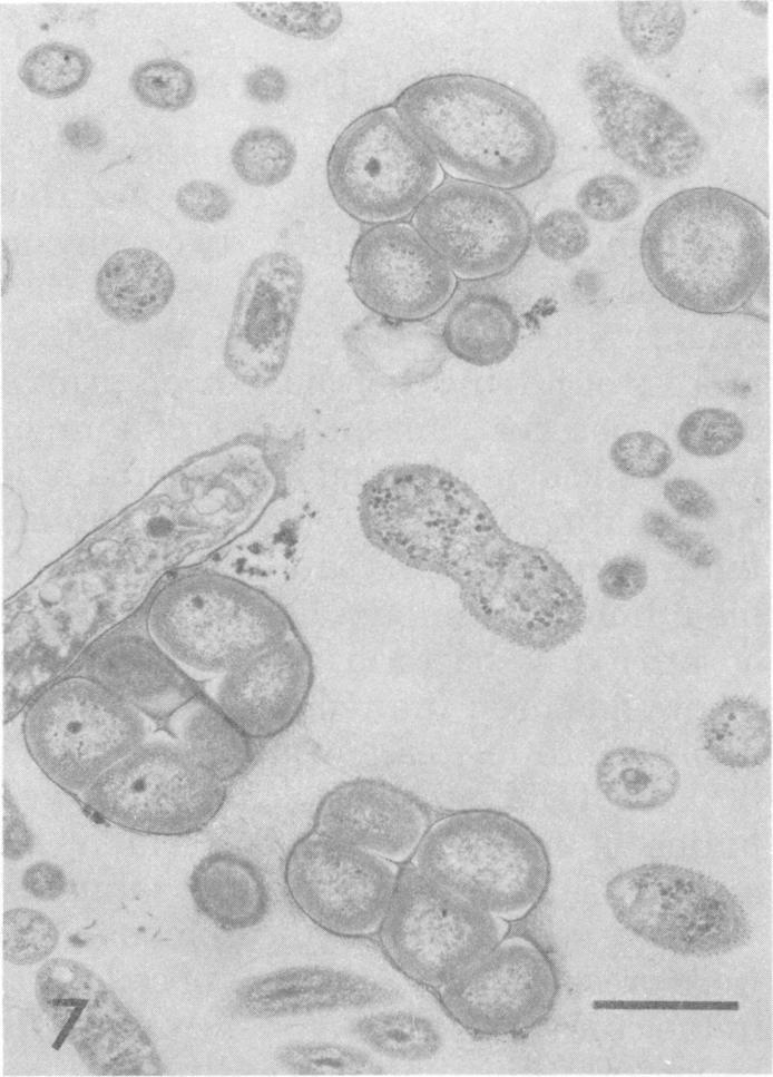https://cdn.ncbi.nlm.nih.gov/pmc/blobs/935b/169790/63df0492417c/aem00003-0116-c.jpg