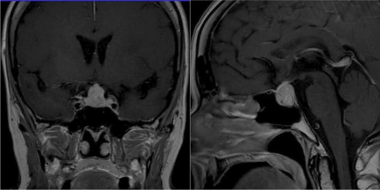 https://cdn.ncbi.nlm.nih.gov/pmc/blobs/935e/8416815/b5504e0bd1d5/11102_2021_1178_Fig2_HTML.jpg