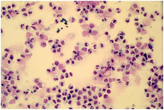 https://cdn.ncbi.nlm.nih.gov/pmc/blobs/9365/7214804/2ed637ee236a/fped-08-00218-g0001.jpg