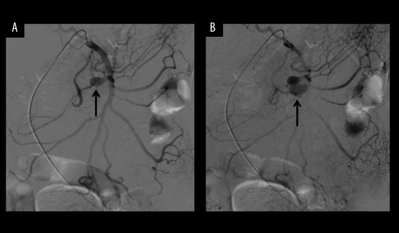 https://cdn.ncbi.nlm.nih.gov/pmc/blobs/9366/4729323/ff82569e10c4/amjcaserep-17-39-g002.jpg