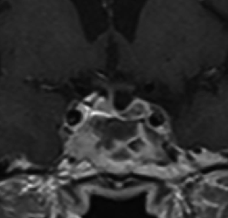 https://cdn.ncbi.nlm.nih.gov/pmc/blobs/9366/7354737/92a1b037b955/EDM20-0018fig3.jpg