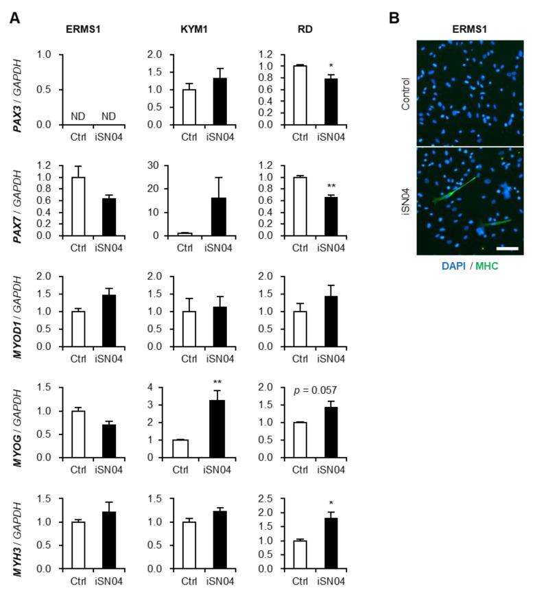 https://cdn.ncbi.nlm.nih.gov/pmc/blobs/9367/9687923/91f0935b7279/biomedicines-10-02691-g004.jpg