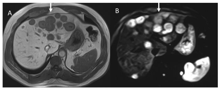 https://cdn.ncbi.nlm.nih.gov/pmc/blobs/936c/10529975/f16cd259b839/diagnostics-13-02877-g005.jpg