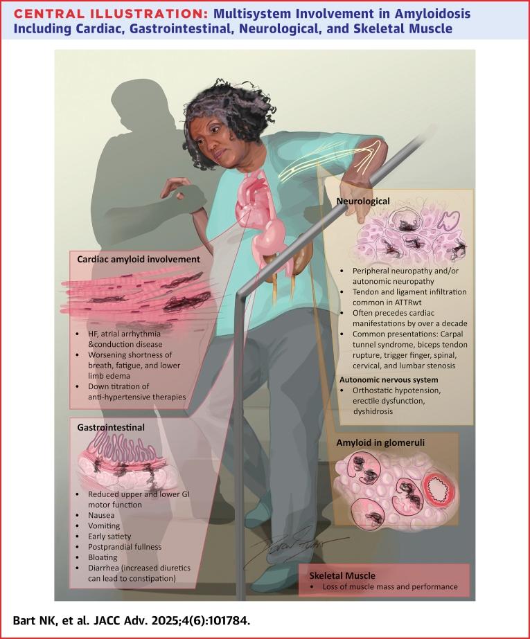 https://cdn.ncbi.nlm.nih.gov/pmc/blobs/936c/12144467/0f571d4ef780/ga1.jpg