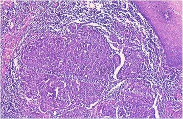 https://cdn.ncbi.nlm.nih.gov/pmc/blobs/9370/5702189/d702738f9fb6/12907_2017_61_Fig1_HTML.jpg