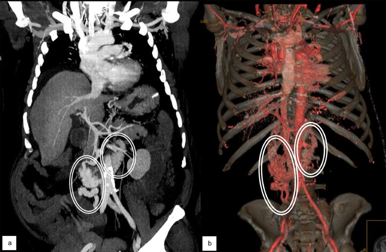https://cdn.ncbi.nlm.nih.gov/pmc/blobs/9382/8093421/91231375b3a0/gr2.jpg