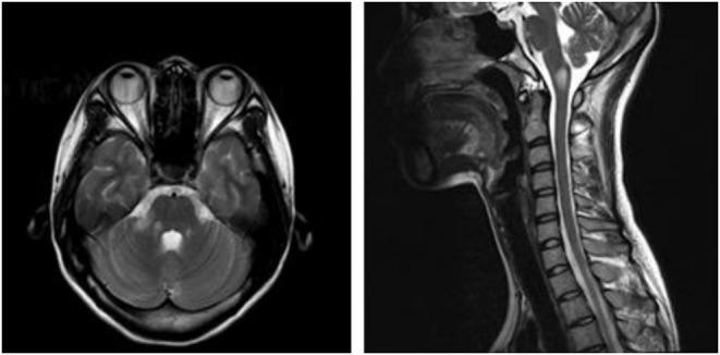 https://cdn.ncbi.nlm.nih.gov/pmc/blobs/9385/8739890/3faa337ad09f/fneur-12-803116-g0001.jpg