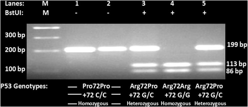 https://cdn.ncbi.nlm.nih.gov/pmc/blobs/938b/6150111/459c4285c099/gr1.jpg