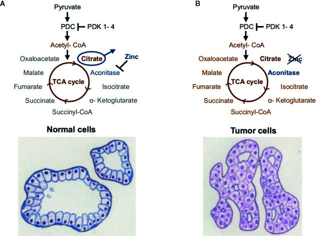 https://cdn.ncbi.nlm.nih.gov/pmc/blobs/9391/7771695/0d3791e5586e/fonc-10-583217-g002.jpg