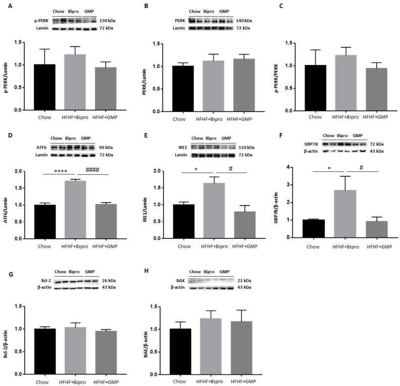 https://cdn.ncbi.nlm.nih.gov/pmc/blobs/9392/10974946/fc642b53b567/nutrients-16-00871-g005.jpg