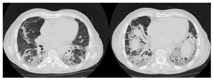 https://cdn.ncbi.nlm.nih.gov/pmc/blobs/9393/11817385/06753be7295f/diagnostics-15-00275-g003.jpg