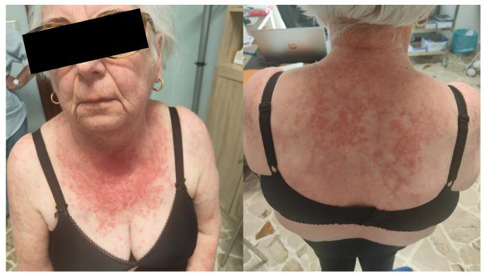 https://cdn.ncbi.nlm.nih.gov/pmc/blobs/9393/11817385/818e16eca595/diagnostics-15-00275-g001.jpg