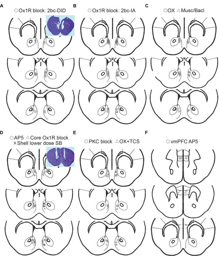 https://cdn.ncbi.nlm.nih.gov/pmc/blobs/9393/6381036/9d3d14d4c6c4/fnins-13-00088-g006.jpg