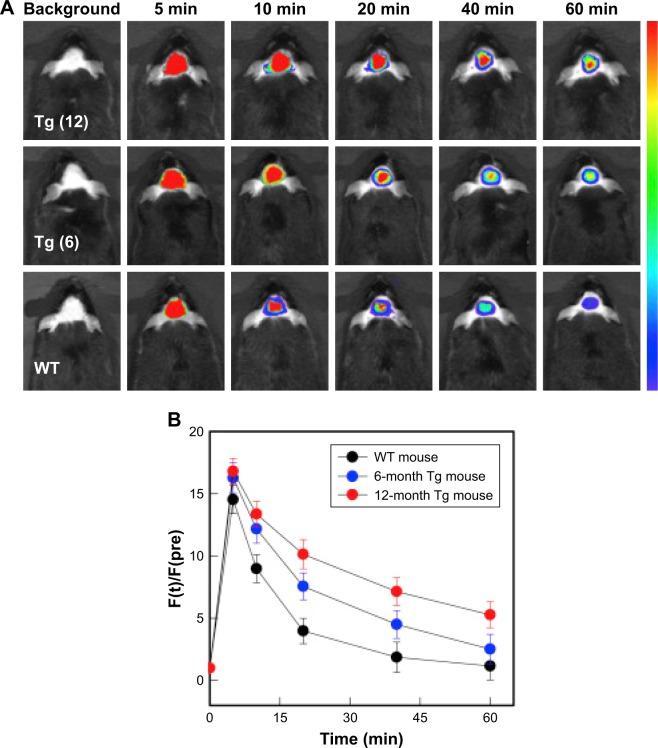 https://cdn.ncbi.nlm.nih.gov/pmc/blobs/939d/6154717/1d5fb0d67e45/ijn-13-5561Fig4.jpg
