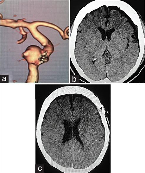 https://cdn.ncbi.nlm.nih.gov/pmc/blobs/93a5/6159057/bcdc58345f94/AJNS-13-707-g007.jpg