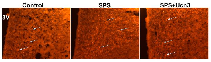 https://cdn.ncbi.nlm.nih.gov/pmc/blobs/93ab/11594197/9cd8d4ab5e32/ijms-25-11908-g006.jpg