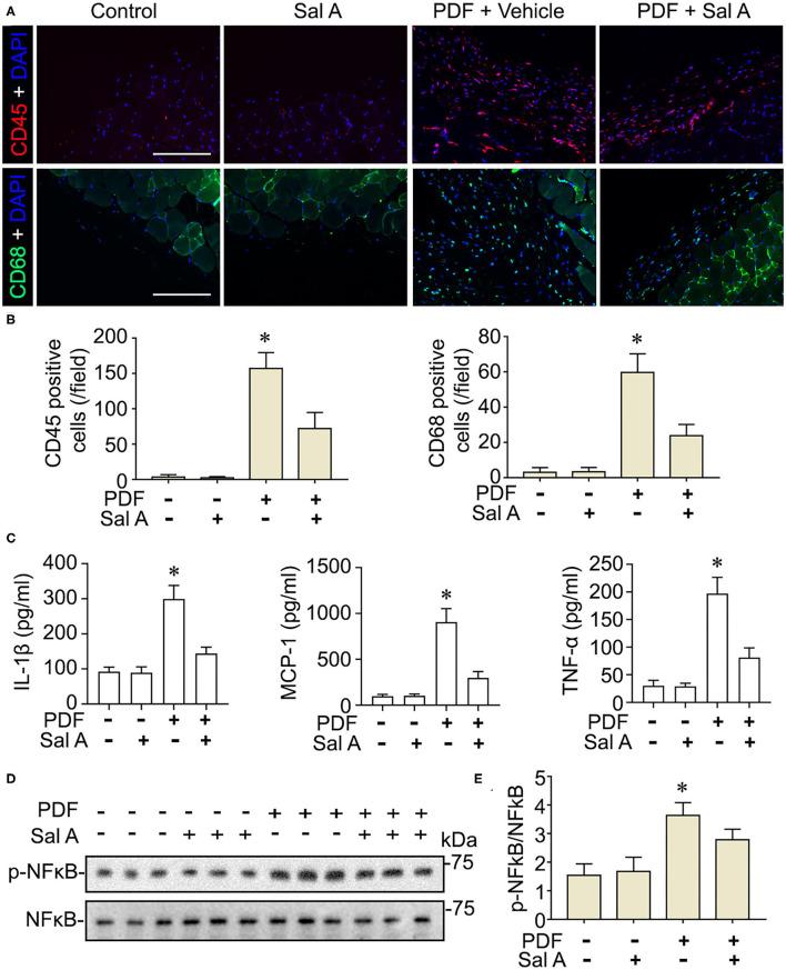 https://cdn.ncbi.nlm.nih.gov/pmc/blobs/93ac/8936188/192bc3f78427/fmed-09-804899-g0004.jpg
