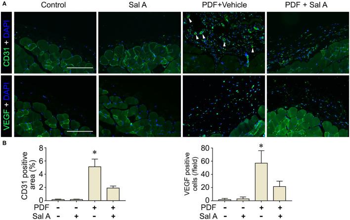https://cdn.ncbi.nlm.nih.gov/pmc/blobs/93ac/8936188/c879776b6932/fmed-09-804899-g0005.jpg
