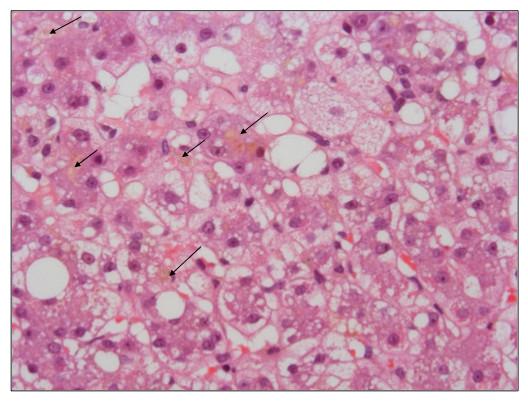 https://cdn.ncbi.nlm.nih.gov/pmc/blobs/93bb/3228746/8e428f0697ec/1471-230X-11-115-3.jpg