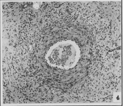 https://cdn.ncbi.nlm.nih.gov/pmc/blobs/93c8/1827920/34b77a85c2c6/canmedaj01707-0093-d.jpg