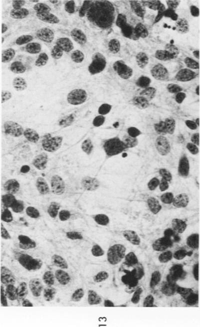 https://cdn.ncbi.nlm.nih.gov/pmc/blobs/93c8/1912641/7c03251afe74/amjpathol00461-0173-a.jpg