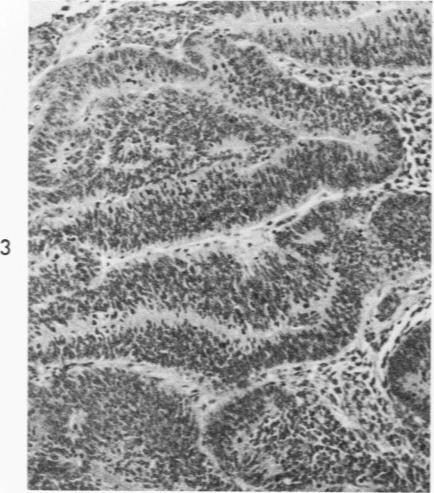 https://cdn.ncbi.nlm.nih.gov/pmc/blobs/93c8/1912641/a9c7a665c787/amjpathol00461-0169-c.jpg