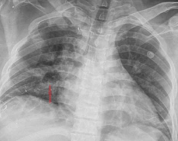 https://cdn.ncbi.nlm.nih.gov/pmc/blobs/93d1/7881427/0e0cdad83dd2/NCI-8-82-g001.jpg