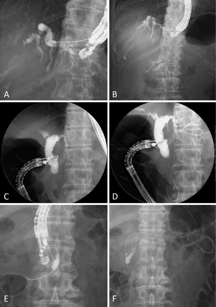 https://cdn.ncbi.nlm.nih.gov/pmc/blobs/93d8/5742383/1a6342c4ab16/1349-7235-56-3135-g001.jpg